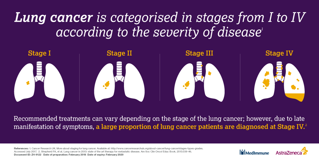 Chemo for lung cancer stage 2