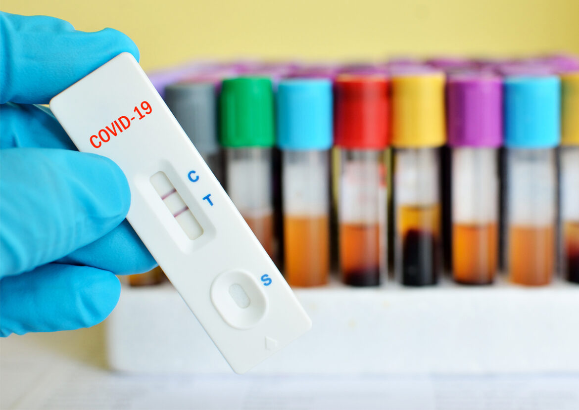 COVID-19 test kits. The Pinoy-made test kits